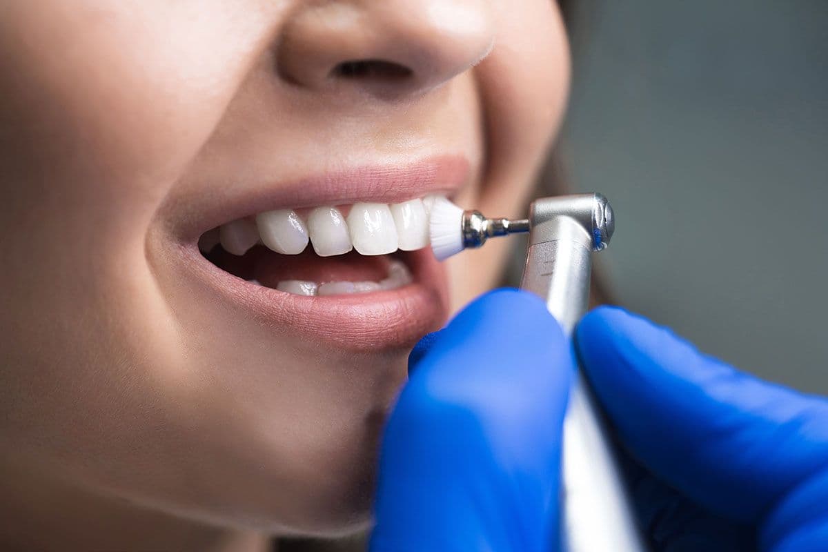 dental+cleaning