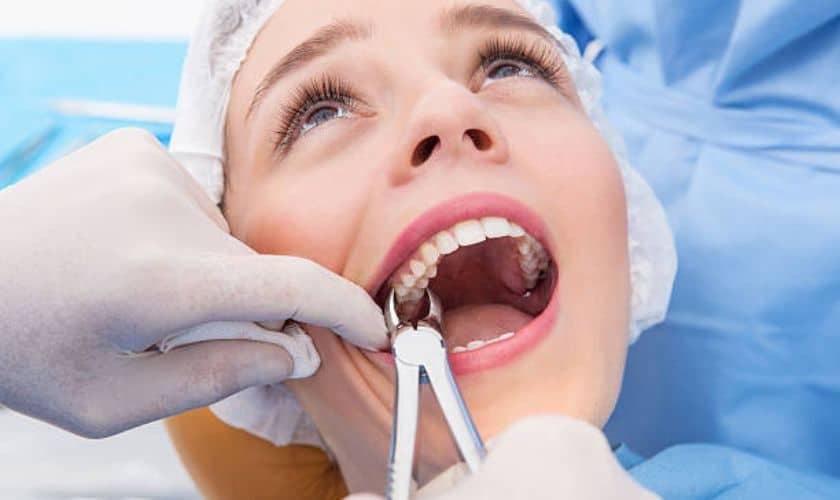 Tooth-Extraction-in-Gallatin-TN